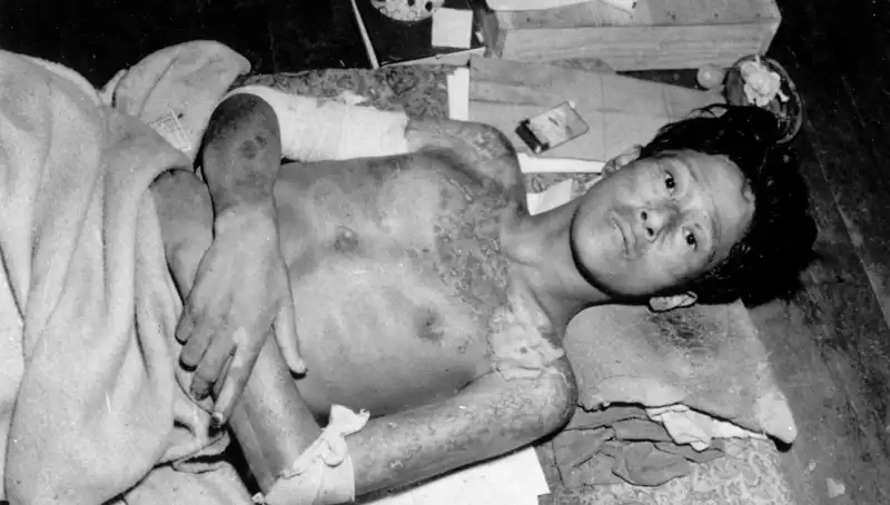 80 Yıl Sonra Nagasaki’den Gelen Korkutucu Uyarı: Nükleer Tehditler Artıyor