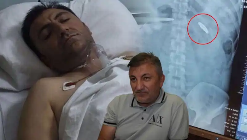 15 Temmuz’un Karanlık Gecesi: Kurşunla Yaralananların Unutamadığı Acı Hayatlar